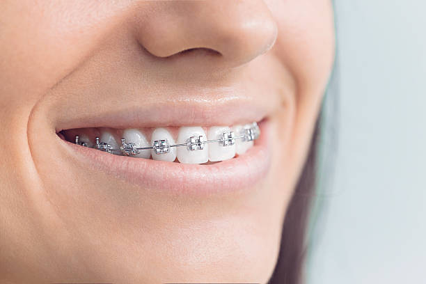 Dental Bonding in Murillo, TX